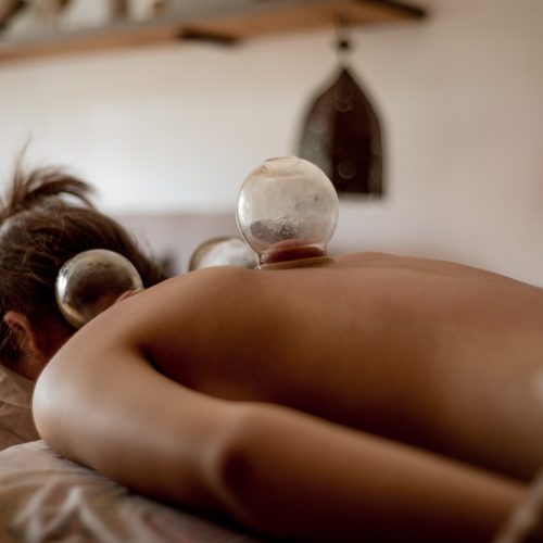 Relaxed young woman receiving cupping treatment on back, traditional chinese medicine.